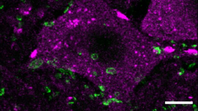 Epigenetic Treatment Supports Spinal Cord Regeneration in Mice content piece image 