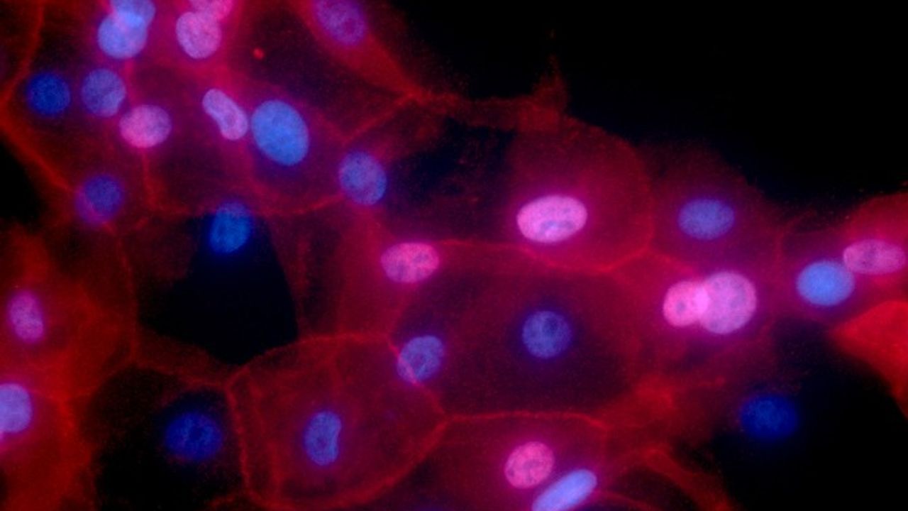 Drug Can Differentiate Breast Cancer Cells in Mice To Become Less Harmful
