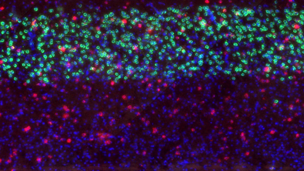 Attention and Running Influence Individual Brain Cells Independently