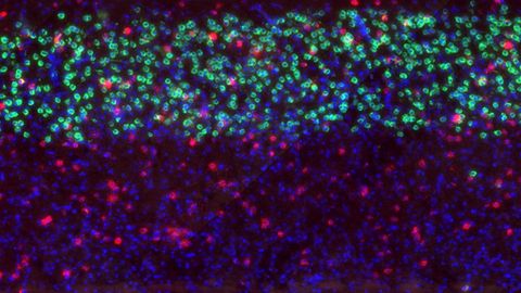 Attention and Running Influence Individual Brain Cells Independently