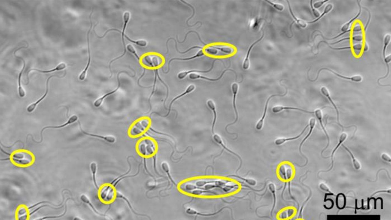 Teams of Sperm Swim More Smoothly Against the Current