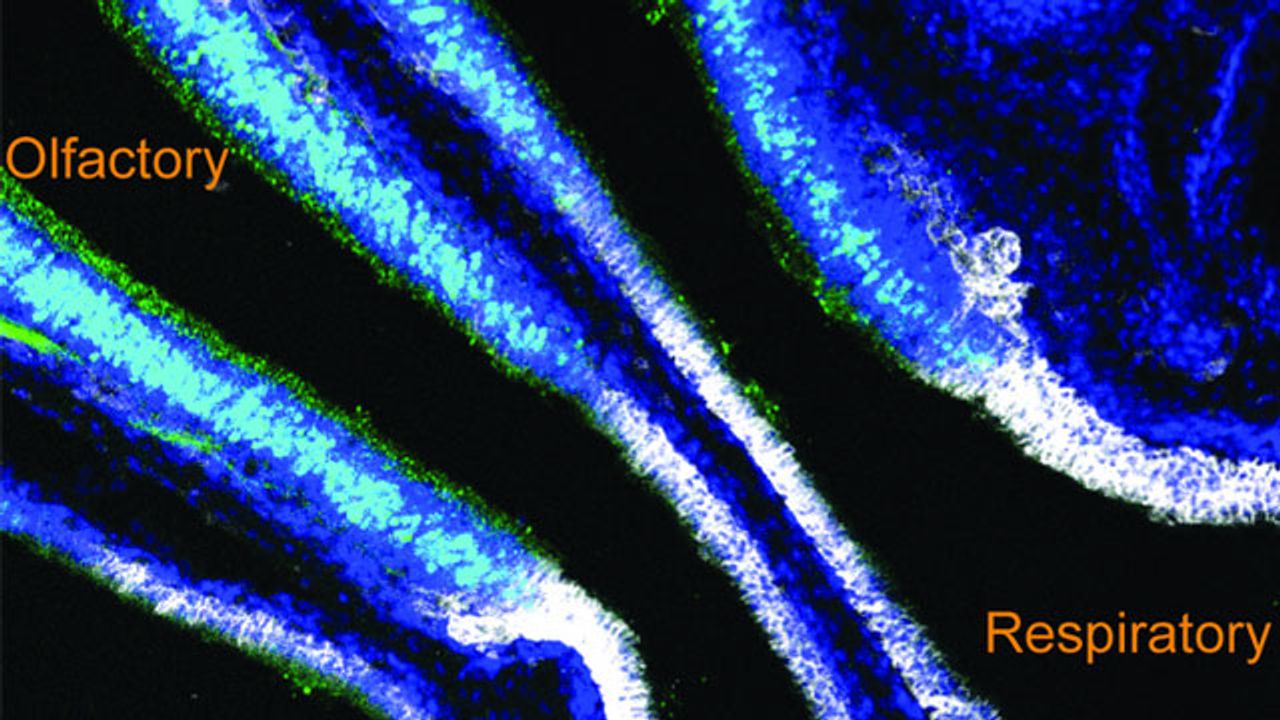 Newly Discovered Barrier Prevents Immunity From Reaching Smell-Sensing Cells