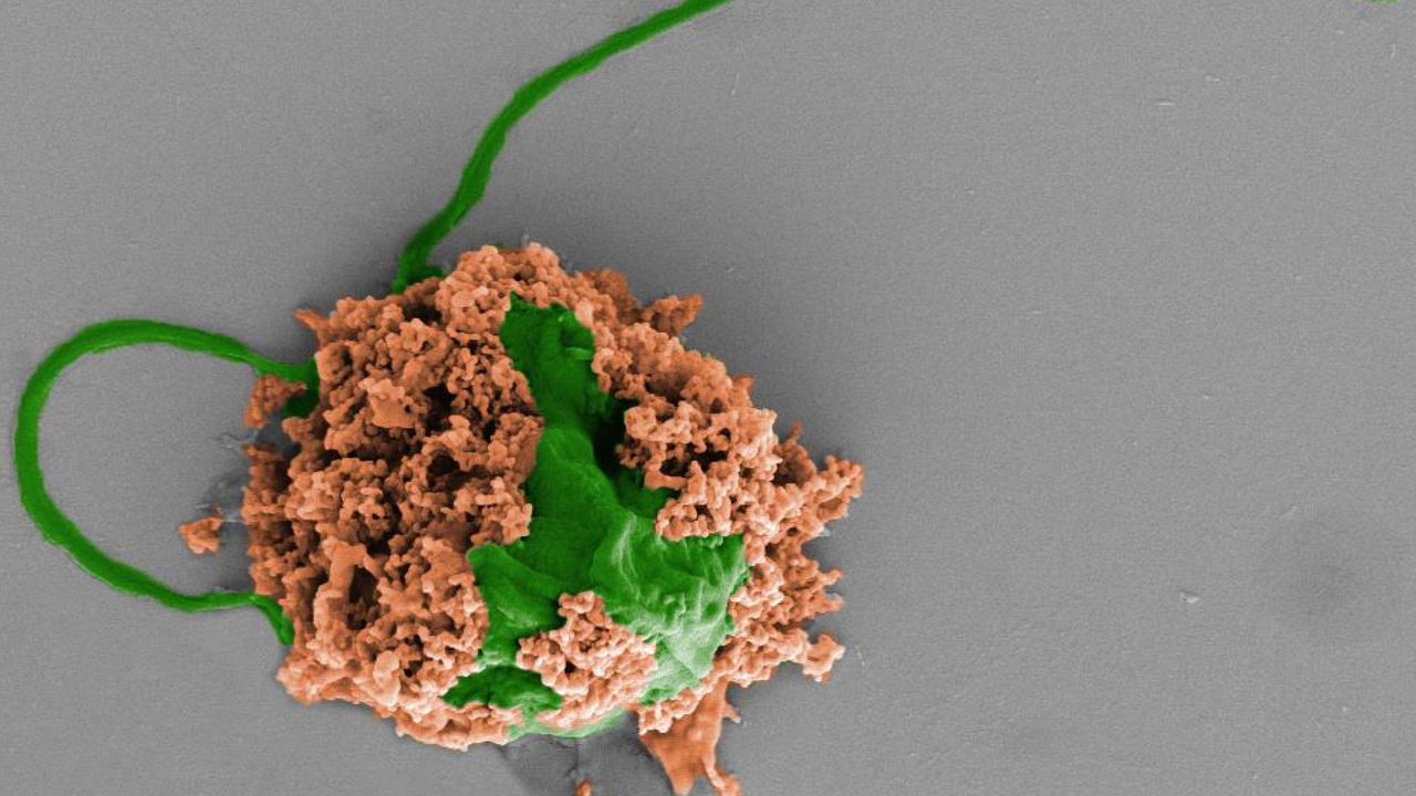 Swimming Microrobots Treat Deadly Pneumonia in Mice