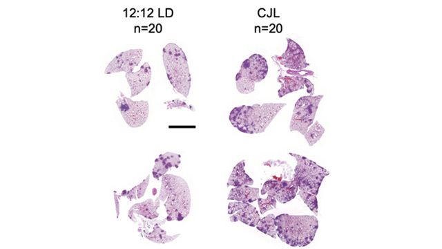 Temperature Regulation Genes May Link Circadian Rhythm Disruption to Cancer content piece image 