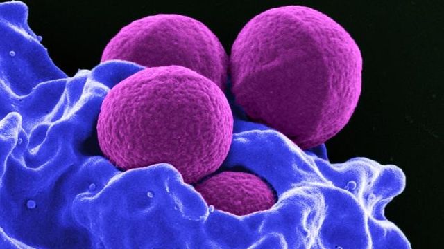 Microscope image of four magenta-colored, spherical, MRSA bacteria, on a blue-colored human white blood cell. 