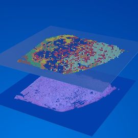 Visium Spatial Gene Expression: Map Transcriptomes Within Tissue ...