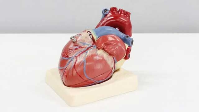 A model of a human heart. 