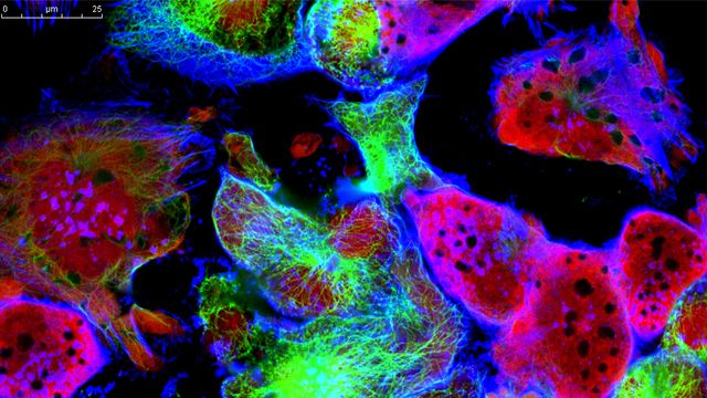 Spatial Biology: The Next Revolution in Understanding Health and ...