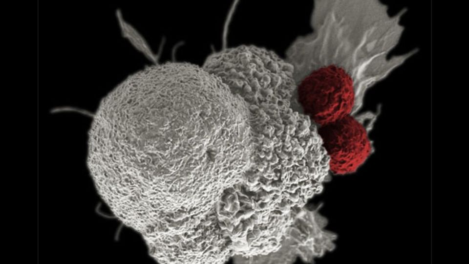 Two cytotoxic T cells attack a cancer cell.