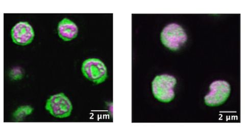 Images of a C. elegans nucleolus, the first is highly structured and the second, with gene disruption, is disordered.