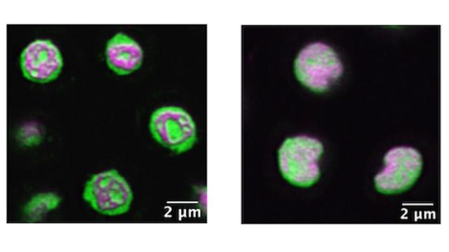 Images of a C. elegans nucleolus, the first is highly structured and the second, with gene disruption, is disordered. 