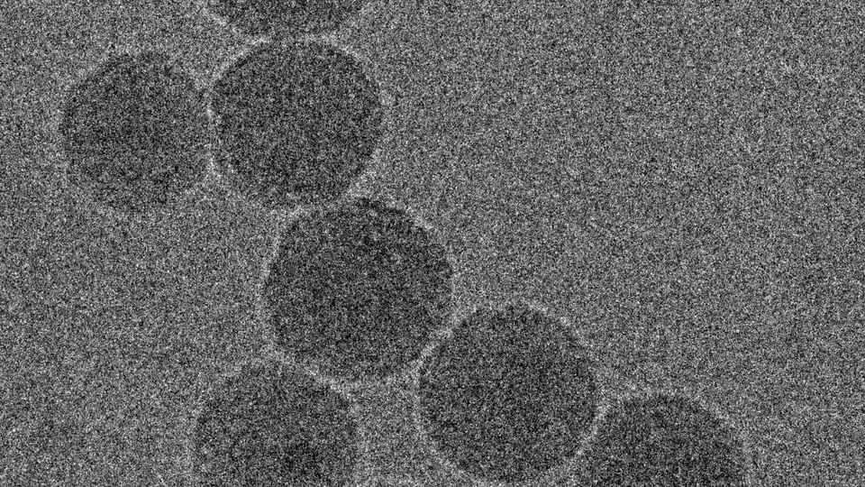 Electron microscopy image of the nanoparticles that contain the chemotherapy drug and novel immunotherapy.