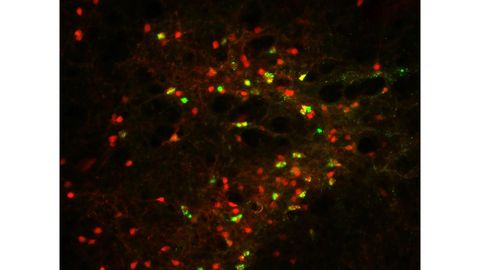 corticotropin-releasing hormone neurons in the lateral interstitial nucleus of the posterior limb of the anterior commissure region.
