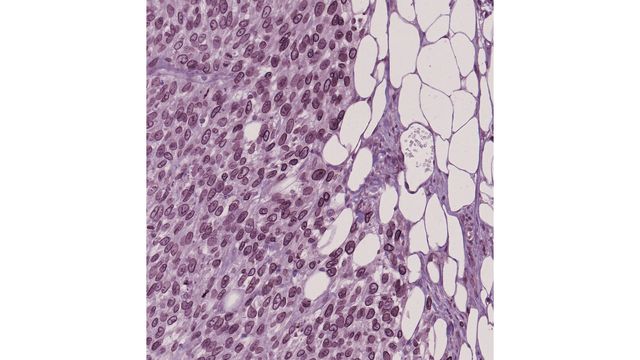 Immunohistochemistry of the invasive front of a melanoma tumor grown in the dermis of mice. 