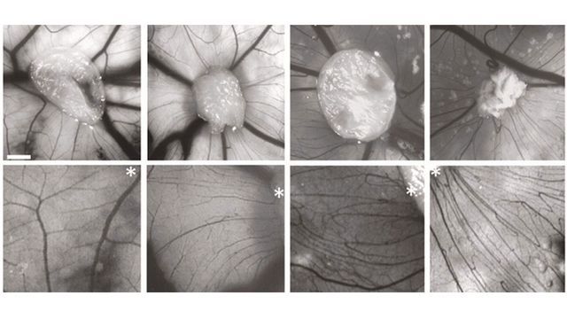 Black and white microscope images of the vasculature associated with astrocytes in people with schizophrenia and controls.