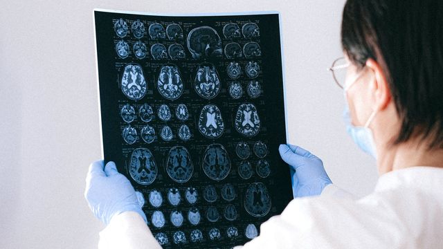 A doctor holds brain MRI results in both hands.