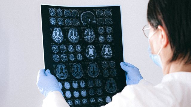 A doctor holds brain MRI results in both hands. 