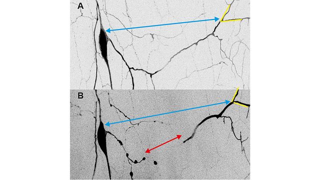 A diagram illustrating how mechanical forces act on dendrites during pruning. 