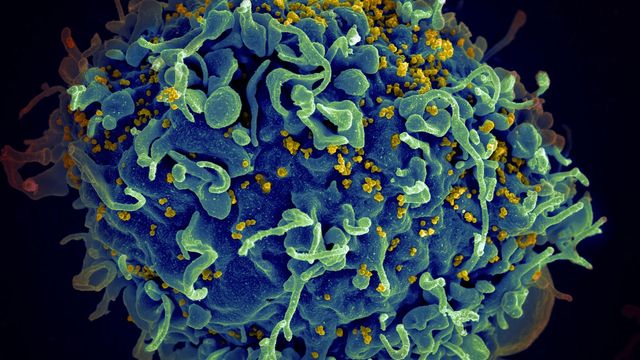 Small yellow-colored virus particles infecting a large, textured blue-colored cell.