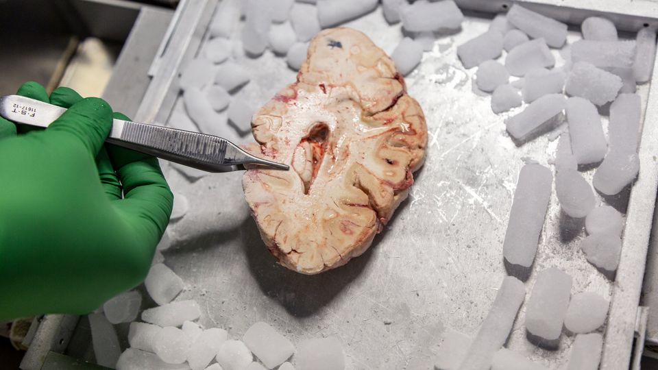 A scientist holds a chunk of brain with tweezers. 