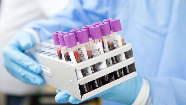 How Do Blood Tests Work? Medical Laboratory Scientists Explain the ...