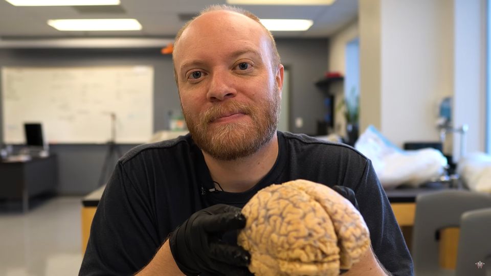 A man holds a human brain.
