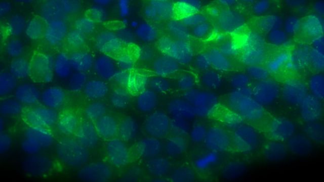 Human embryonic stem cells viewed under the microscope, stained with blue and green fluorescent dyes.  