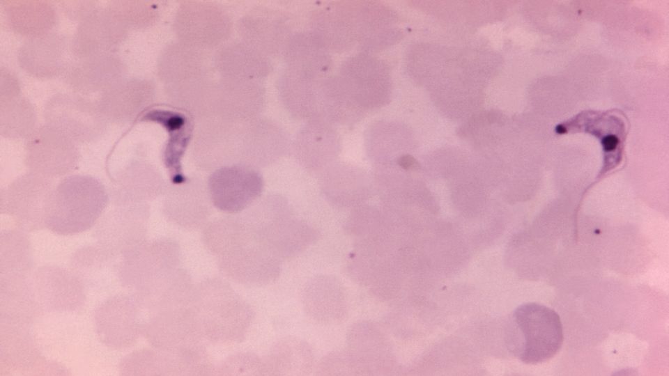 A blood smear specimen in whic two, Trypanosoma cruzi trypomastigotes can be seen.
