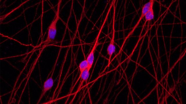 Four Hacks for Culturing Neurons content piece image 