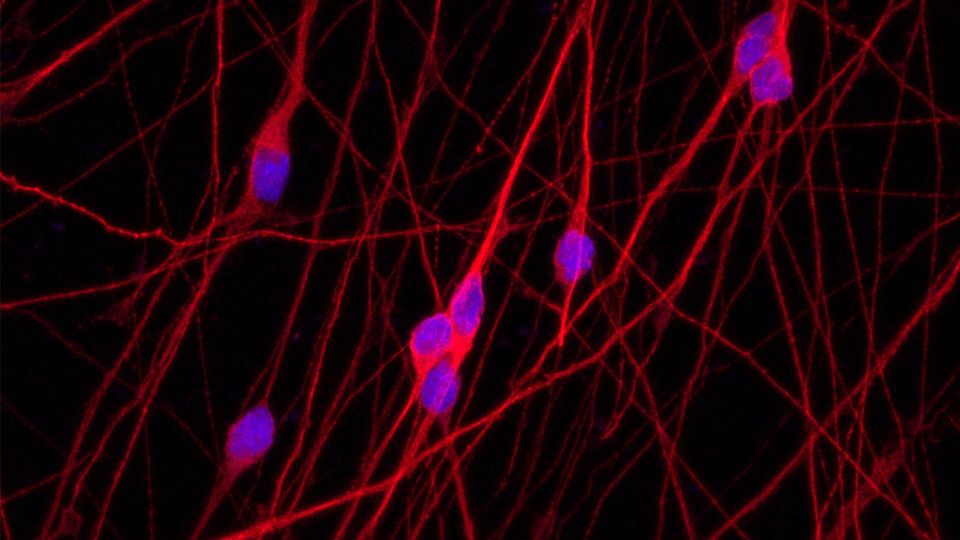 Four Hacks for Culturing Neurons content piece image