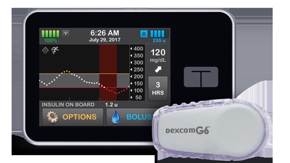 Artificial pancreas system.