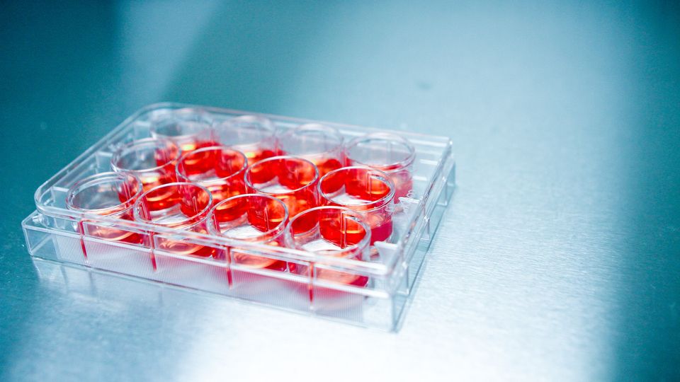 How To Detect and Avoid Cell Culture Contamination Technology Networks