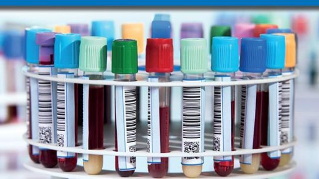 Large-Scale Plasma Proteomics With PASEF | Technology Networks