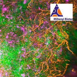 探索肿瘤神经支配与组织清算和3 d成像图像内容块