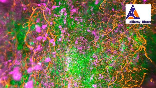 Exploring Tumor Innervation With Tissue Clearing and 3D Imaging Webinar