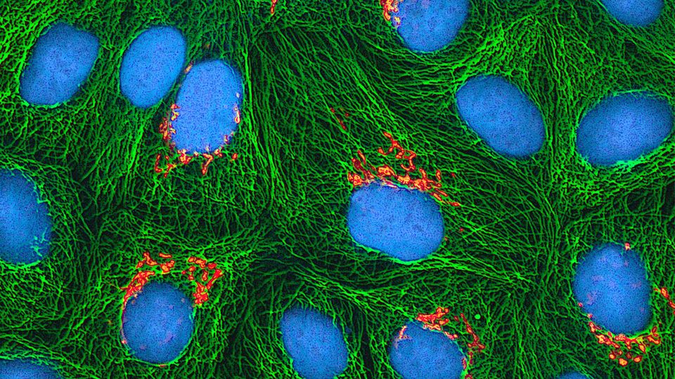 HeLa cells.