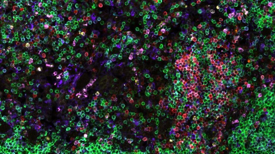 Immune Profiling for Disease