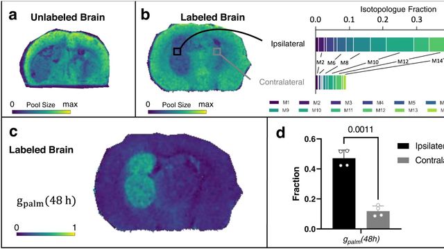 New Spatial Imaging Method Measures Flow of Nutrients in Tumors ...