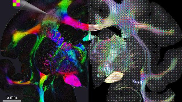 Scattered Light Imaging Disentangles the Brain's Complex Web ...