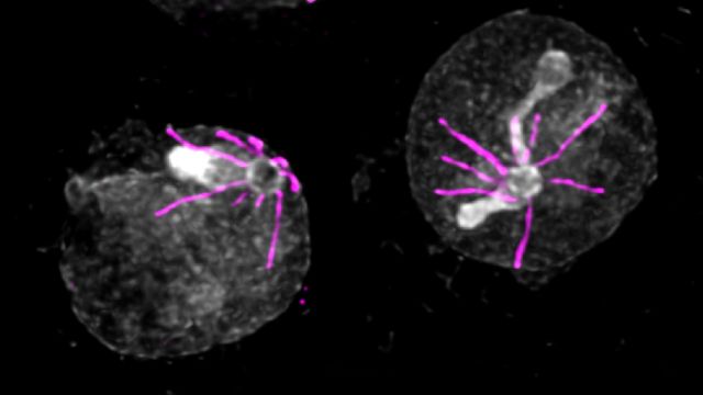 Image of Plasmodium as seen by expansion microscopy. 