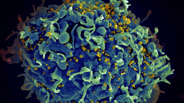 HIV infecting a human cell. 