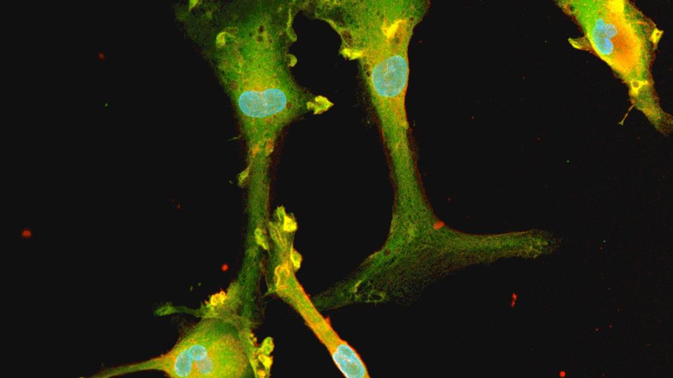 Bit.bio Microglia Neurodegeneration