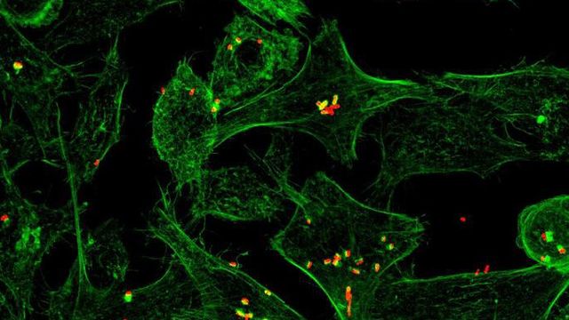 Fluorescent imaging of cells becoming infected with bacteria. 