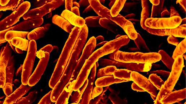 Orange-colored, rod shaped Mycobacterium tuberculosis bacteria. 