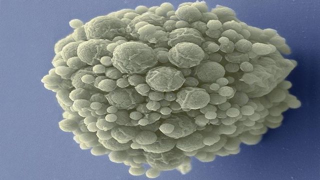 Artificial Cells Can Evolve Just As Quickly as Normal Cells - Vimarsana News