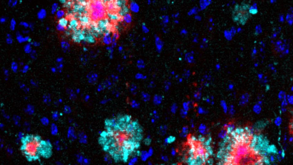 Accumulation of the Arl8b protein around the amyloid-b aggregates.