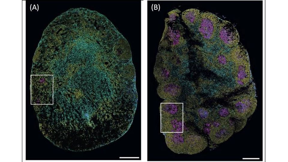 Two images of lymph nodes, one is helminth-resistant and the other is chronically infected.