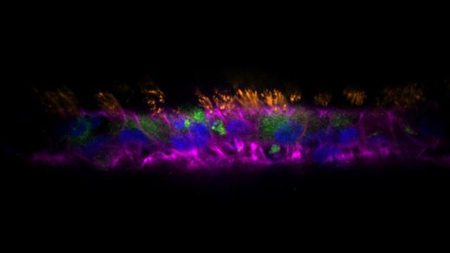 Human Lung Organoids Transform How We Study Respiratory Infections - Vimarsana News