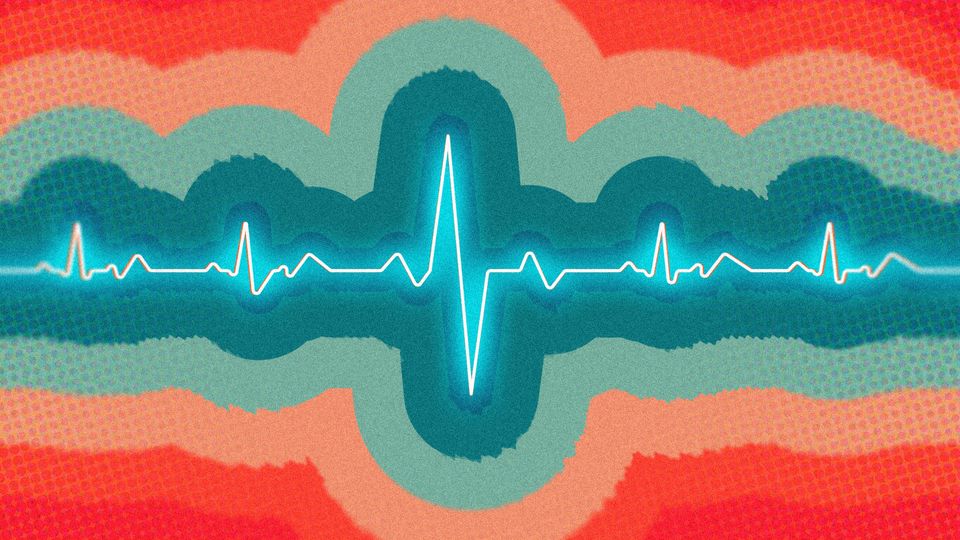 一个迷幻的脉搏。