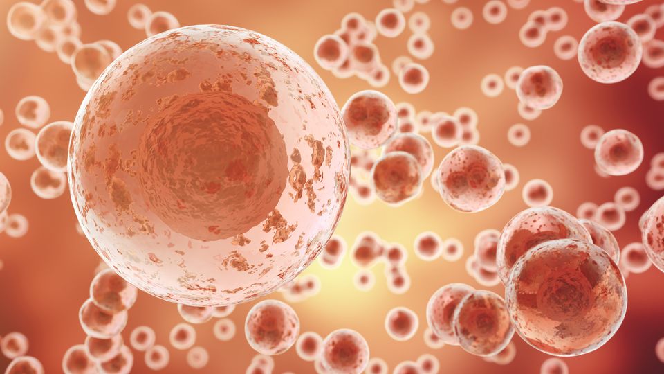 Cancer cells.